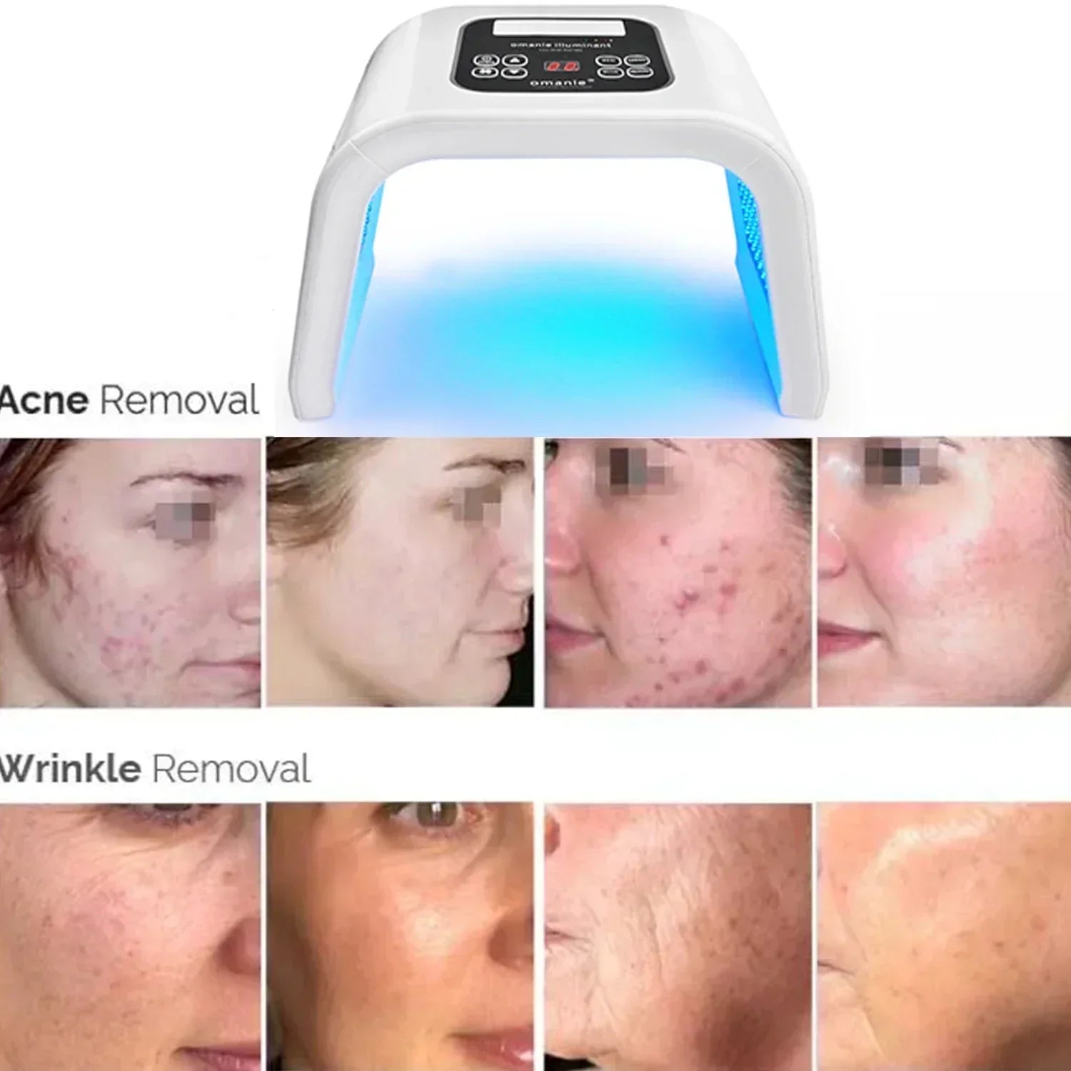 7-Color LED Photon Heating Facial Mask for Home Skin Care