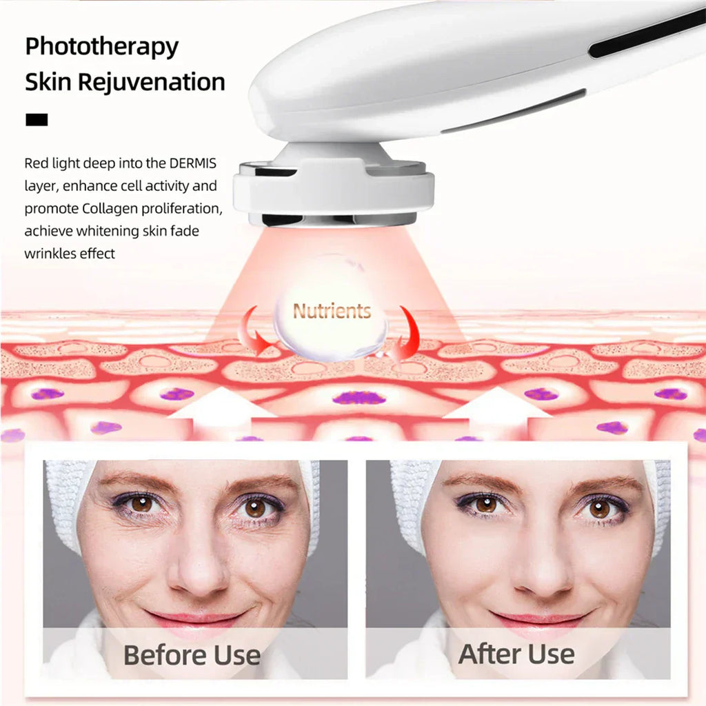 Ultrasonic Skin Scrubber, EMS Massager, LED Light Therapy Beauty - Illuminate, Lift, and Rejuvenate Your Skin