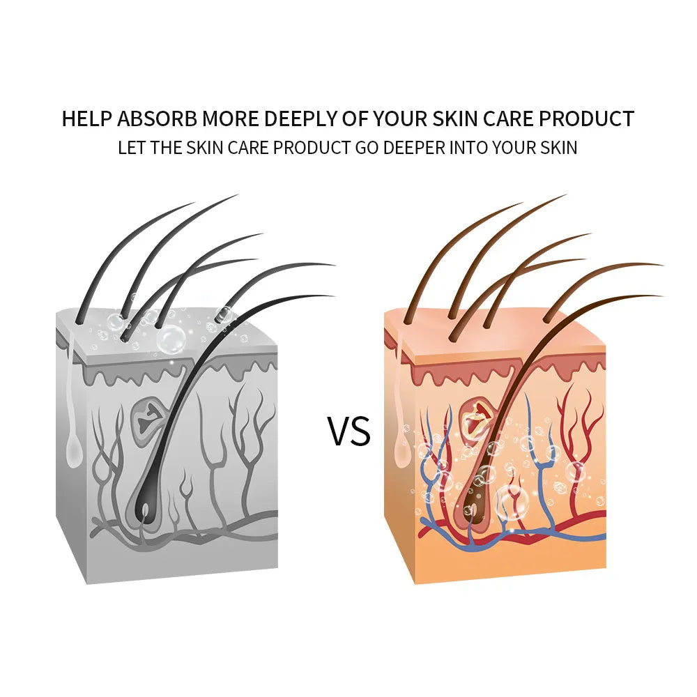 4-in-1 RF Face Lifting Machine: EMS, Micro-current, LED Photon, and Massager for Facial Rejuvenation