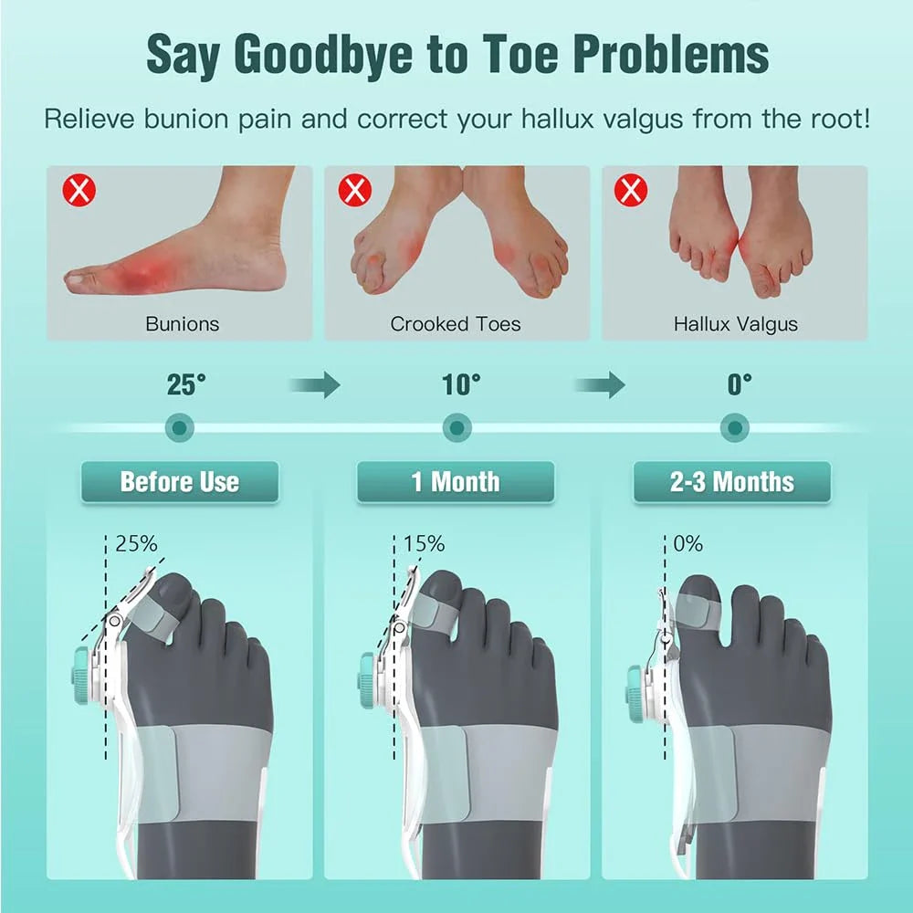 Adjustable Bunion Corrector – Hallux Valgus Big Toe Straightener & Toe Alignment Brace