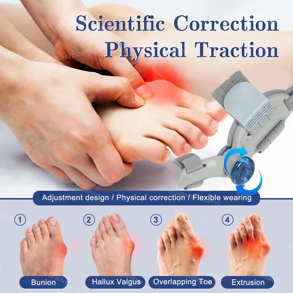Adjustable Bunion Corrector – Hallux Valgus Big Toe Straightener & Toe Alignment Brace