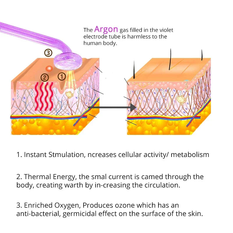 High Frequency Facial Machine with Argon Treatment - Electrotherapy Wand for Acne and Hair Care