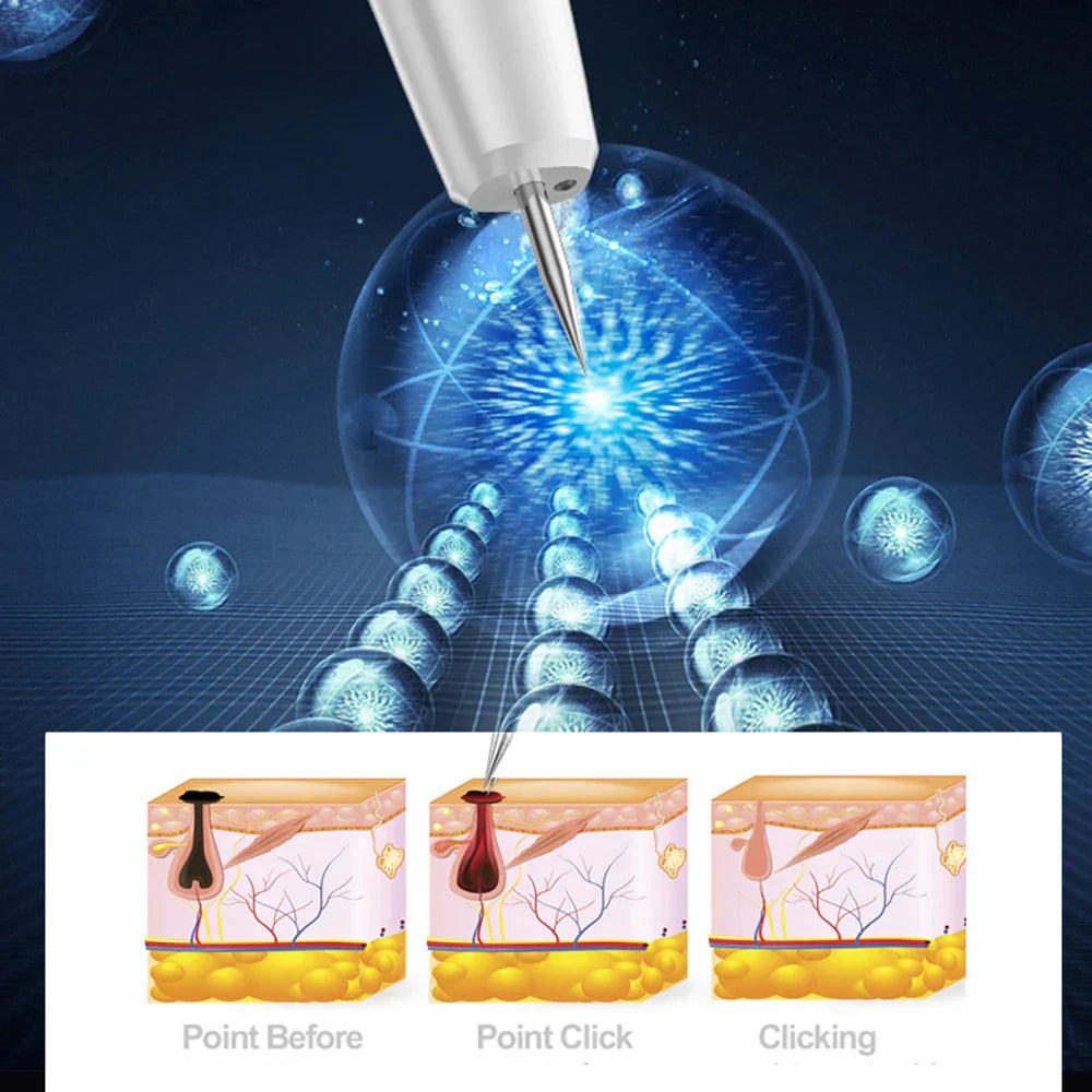 Clear Nevus Beauty Pen - Mole, Black Points, Wart, Spot, Tattoo Remover
