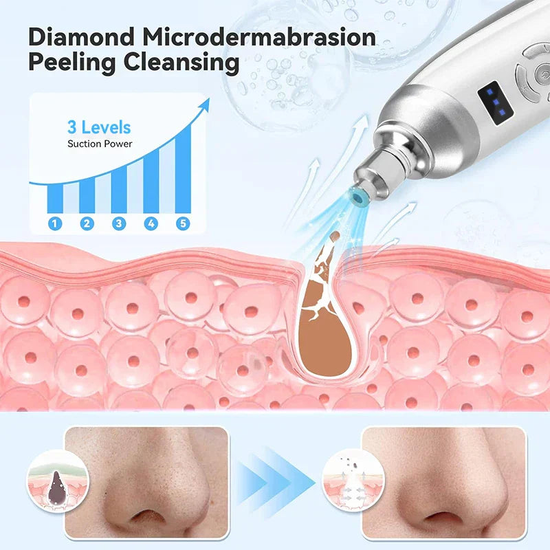 Upgraded Diamond Microdermabrasion Machine White